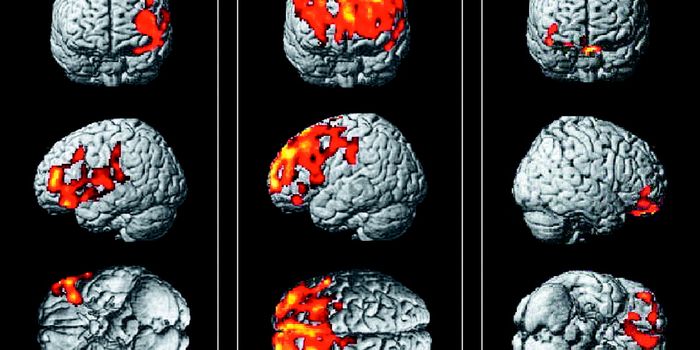 Novel Expression Sites Discovered for ALS Gene