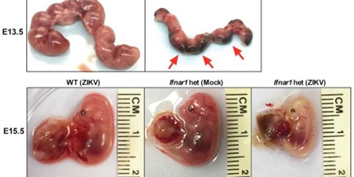 Mouse Model of Zika Confirms Fetal Transmission