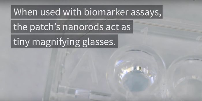 Nanotech patch makes light-up medical tests 100x brighter