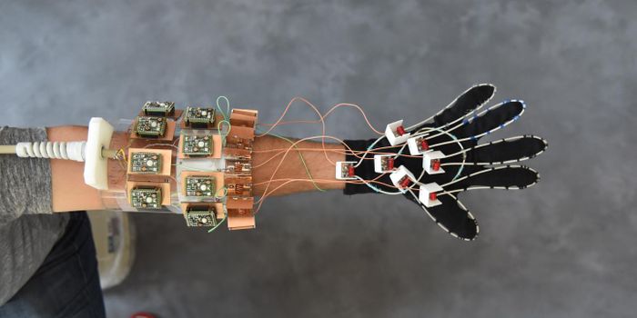 New "MRI Glove" for Bone and Joint Visualization