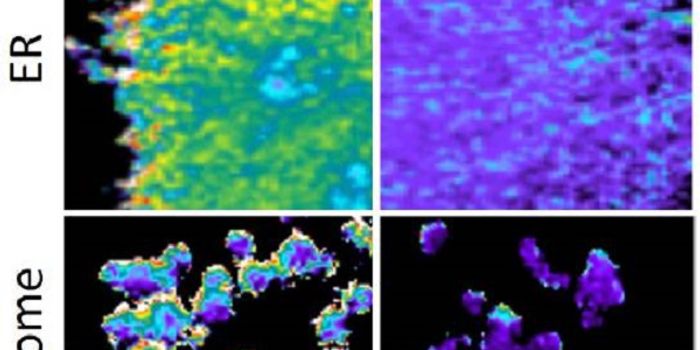 Molecular Spies Sabotage Protein's Acts in Cellular "Rooms"