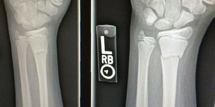 Growing Bones in the Lab