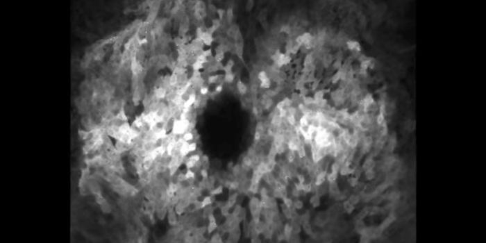 After a Wound, Cells Initiate a Complex Signaling Cascade