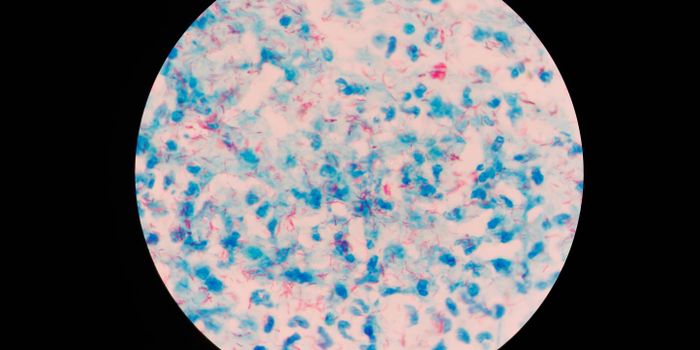 Why TB and HIV Occur Together So Often