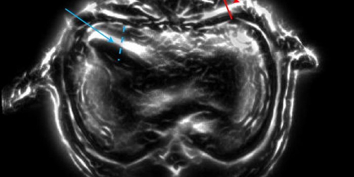 Can You Hear that Laser Beam: a New Photoacoustic Imaging Technique that Explores Anatomy and Physiology with High Spatiotemporal Resolution