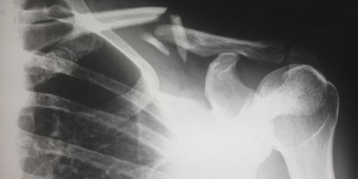 Can Google Health's AI interpret X-rays as well as radiologists?