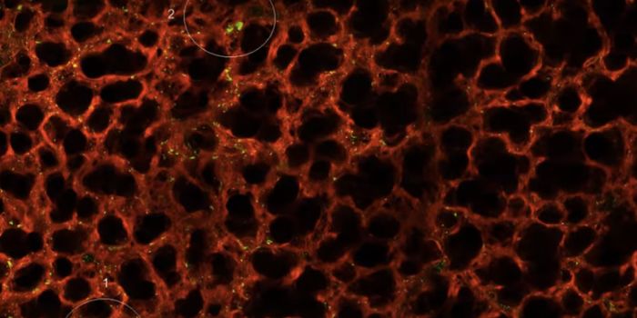 Lungs Found to Have a Role in Platelet Production