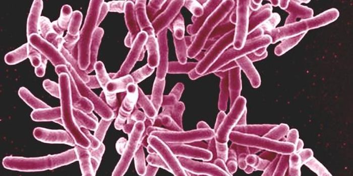 Understanding How Tuberculosis Takes Hold