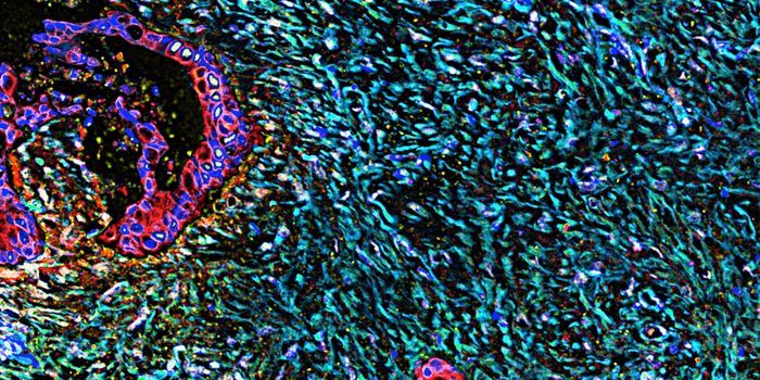 Yin & Yang: The Duality of Cancer-Associated Fibroblasts in Pancreatic Cancer