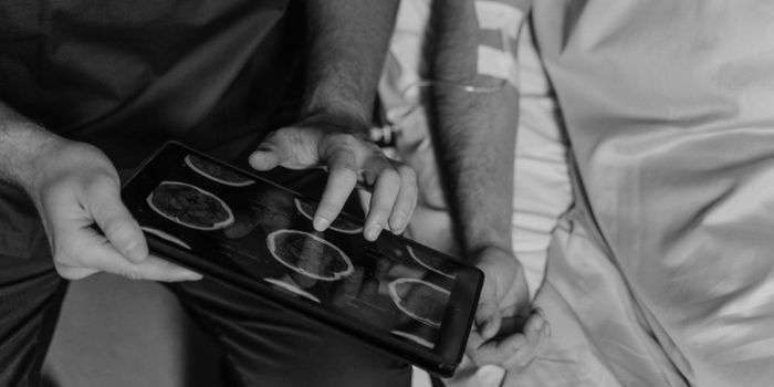 Promising Epilepsy Treatment Suppresses Neuroinflammation