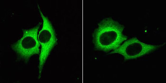 Partnering MicroRNAs & Targets in a Molecular Dance