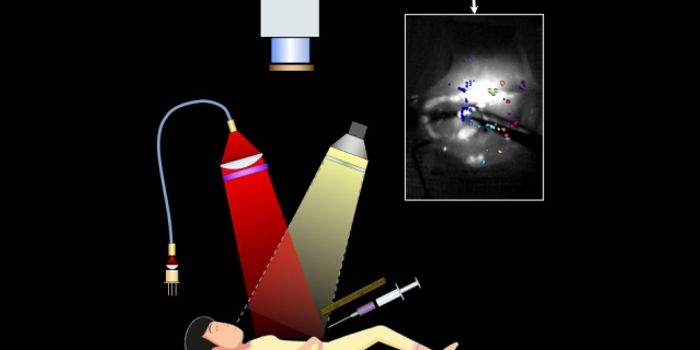 New Imaging System Can Help Eradicate Ovarian Tumors