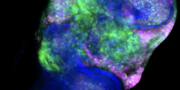 Cancer Cell Fate Influenced by Dietary Amino Acid