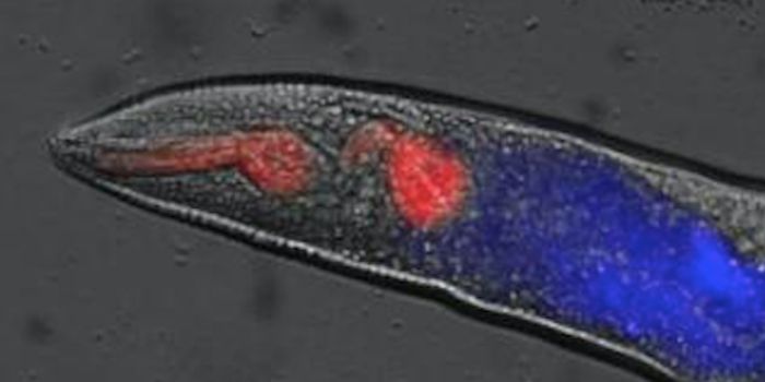 Gaining Insight Into Death Through Worm Rigor Mortis