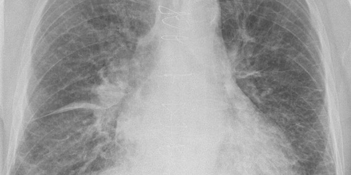 The Surprising Role of Metabolism in Congestive Heart Failure