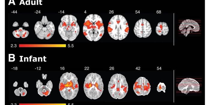 Study: Most Babies Not Medicated for Pain Despite Feeling Pain Like Adults