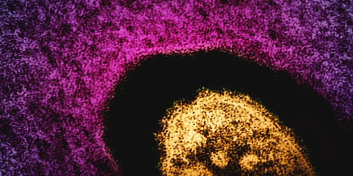 Measles Cases are Soaring Around the World