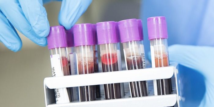 A New Blood Test Can Predict a Person's Risk of Parkinson's