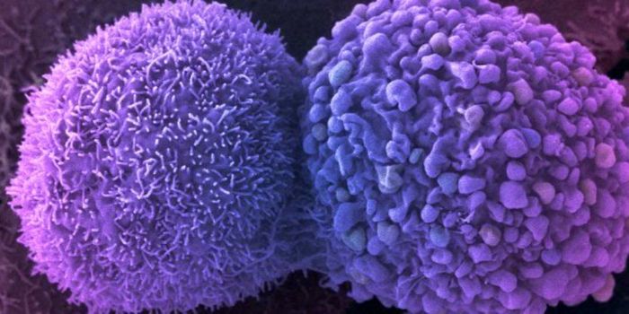 Potential Drug May 'Freeze' Cancer Cells