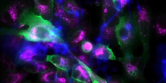 A Fungal Pathogen Can Halt a Protective Process in Lung Cells