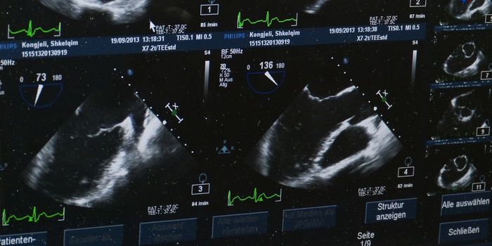 Ultrasound Triggers Immunotherapy to Destroy Tumors