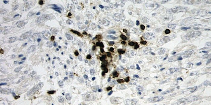 "STING" Leads to T Cell Death