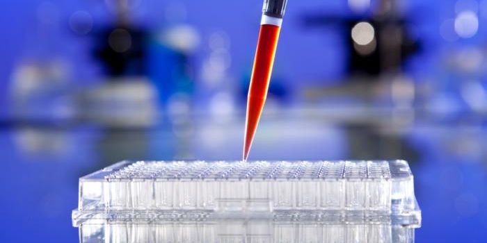 Blood Test Reveals Alzheimer Risks in 3 Hours