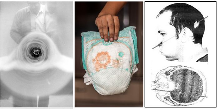 Ferret, Diaper, and Human Flesh--Odd Things that Ended Up in a Particle Accelerator