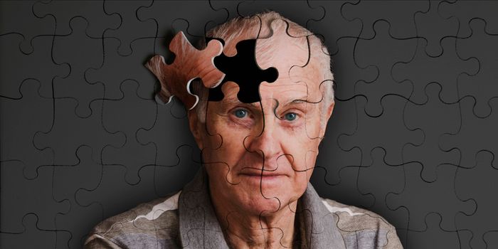 Re-Designing Treatments for Alzheimer Disease