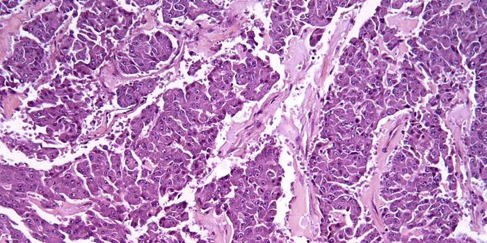 Cancer-Killing Virus Collaborates with the Human Immune System