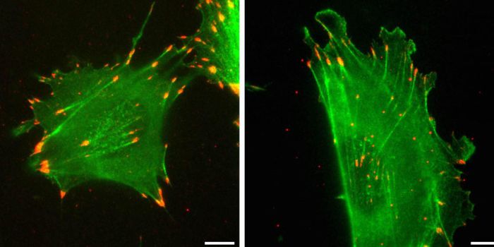 Silent Genetic Substitutions Can Affect Protein Function