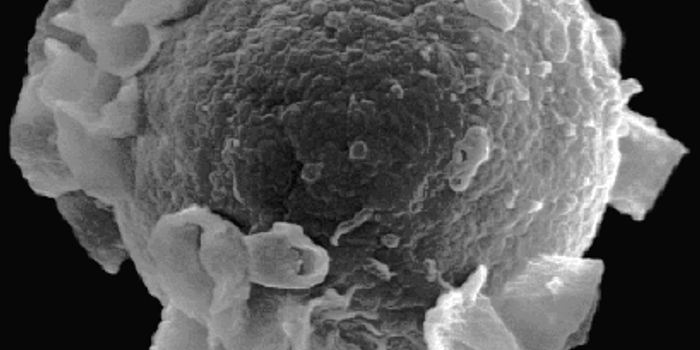 ‘Kissing Disease' Virus Now Linked to Breast Cancer