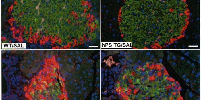 Treatment With Protein S Helps Alleviate Diabetes in Mice