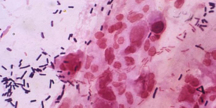 Some Microbes Could Help Treat Type 2 Diabetes