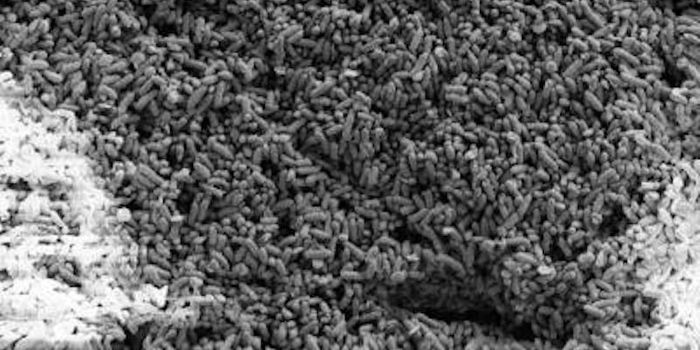 Electric Nanowires Seem to be Ubiquitous Among Microbes