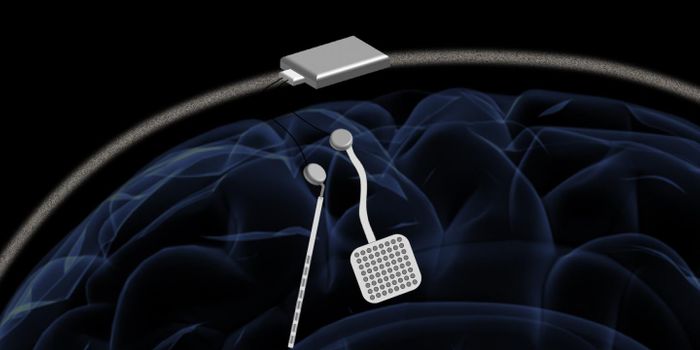 Wireless 128 channel closed loop brain stimulation device