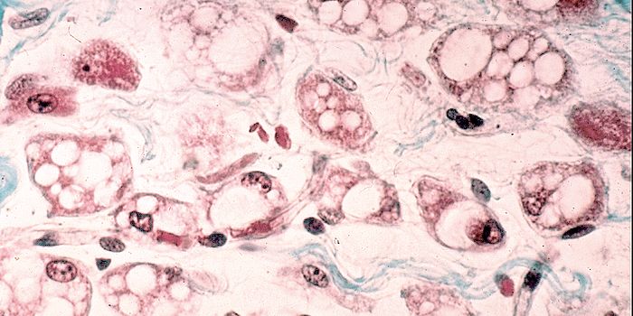 Towards an Understanding of how Brown fat Impacts Health & Disease