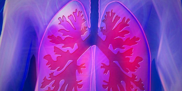 New Small Cell Lung Cancer Subtype Identified