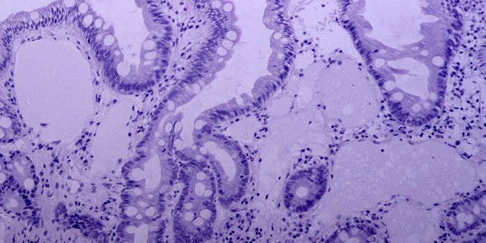 Nematode Infection Reveals Immune Cell "Cross-talk"
