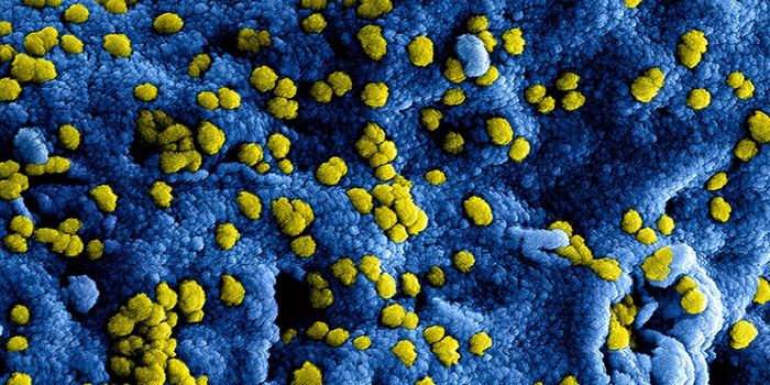 Diabetes and Heart Problems Linked to Worse Prognosis of COVID-19