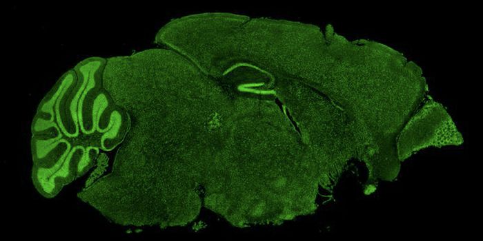 Potential Treatment for Fragile X Syndrome ID'ed