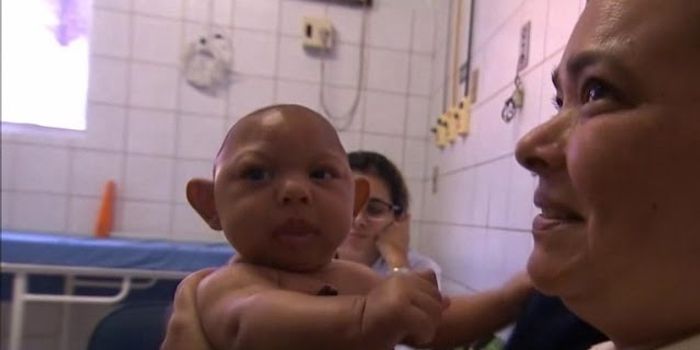 The Link Between Zika and Microcephaly