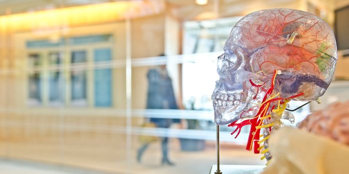 Artificial Intelligence May Soon Detect Brain Aneurysms
