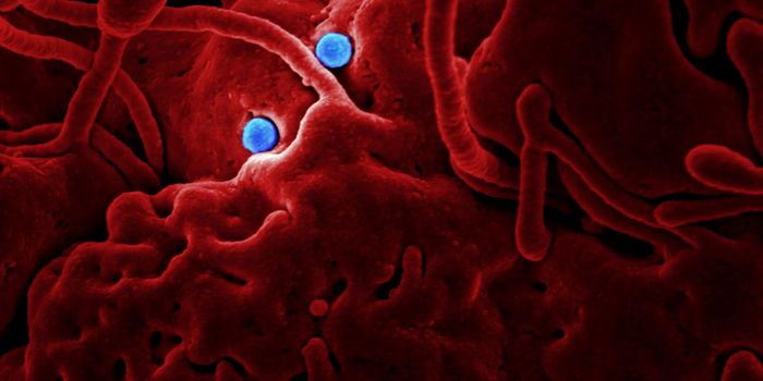 Viruses and Autoimmunity: What Pandemics Have Taught Us