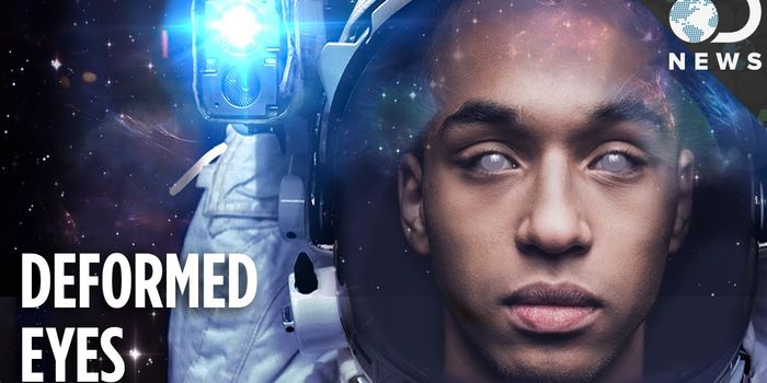 Does Space Travel Lead to Vision Impairment?