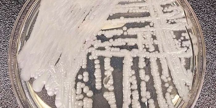 Is Climate Change to Blame for the Rise of Candida auris?