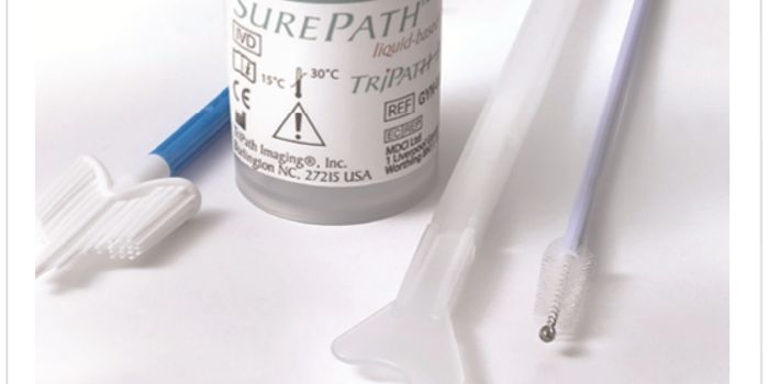 Finally, an HPV test cleared for use with SurePath