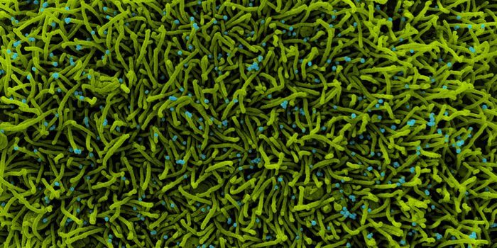 Pregnant Moms Easily Pass On COVID-19 Antibodies Through Placenta