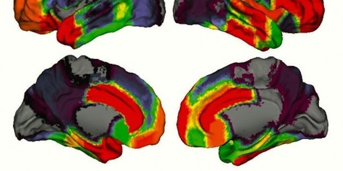 Can We Be Too Brainy to Learn Well?