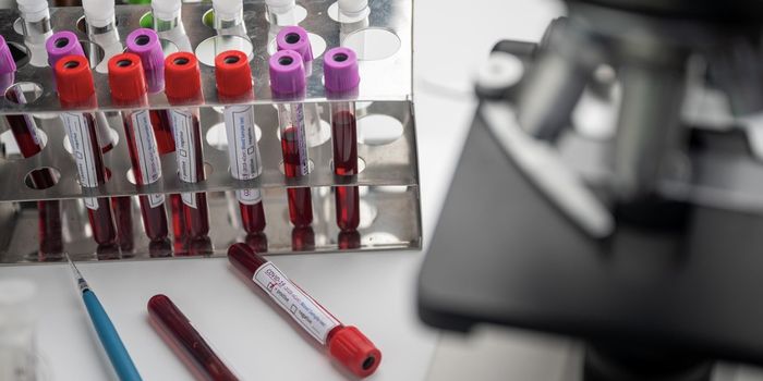 Some Tumor DNA Can Be ID'ed Three Years Before Diagnosis